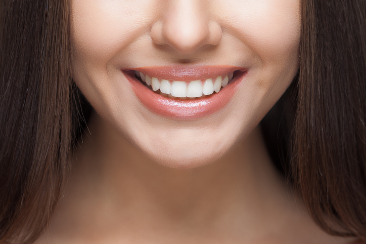 Teeth Whitening - Smile Makers Dental Teeth Whitening - Smile Makers Dental